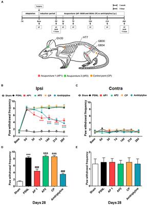 Acupuncture Improves Comorbid Cognitive Impairments Induced by Neuropathic Pain in Mice